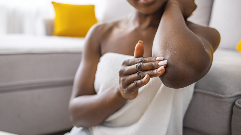 Woman sit on sofa in living room holding small tube with serum caring about skin beauty health care apply ultra-softening cream on elbow area